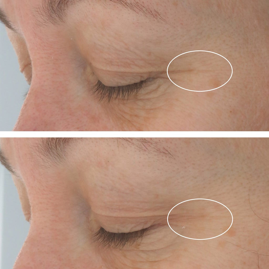 StriVectin Hyaluronic Tripeptide Gel-Cream For Eyes, 0.5 oz, 2-pack - product image