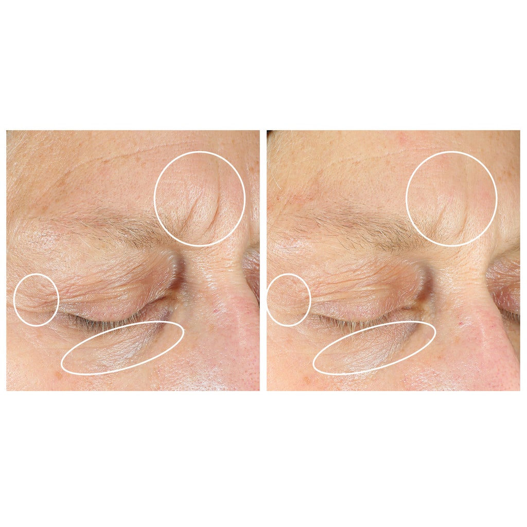 StriVectin Anti-Wrinkle Intensive Eye Concentrate Plus - product image