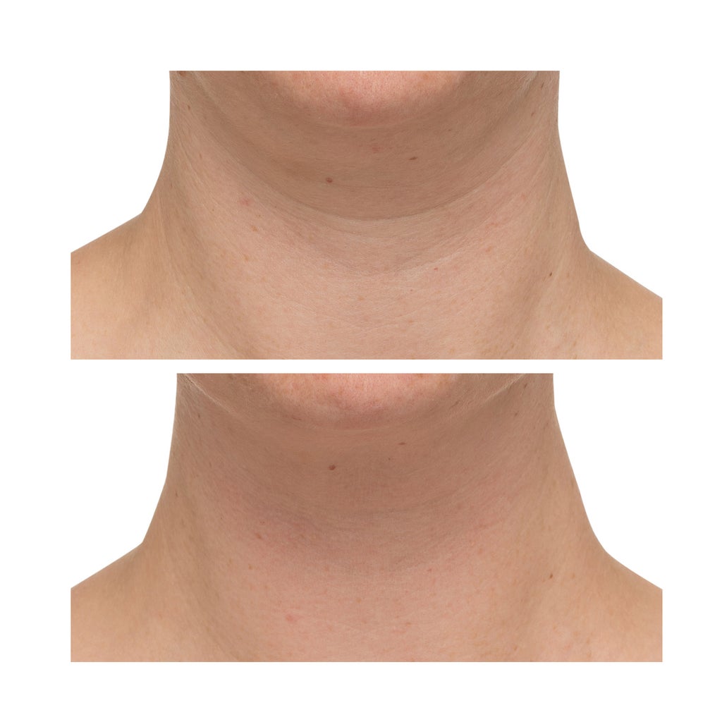 StriVectin TL Advanced Tightening Neck Cream Plus, 1 oz, 2-pack - product image