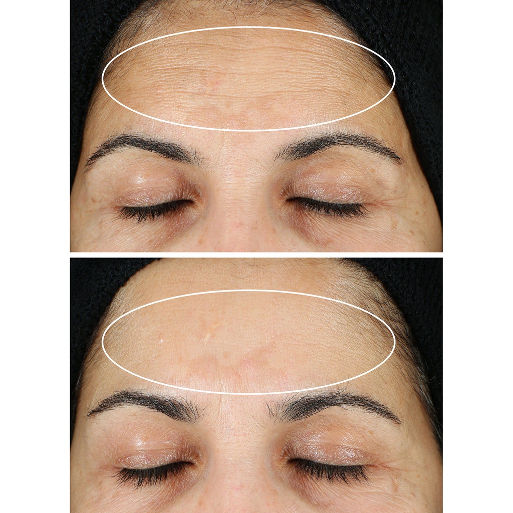 StriVectin Super C Retinol Serum, 1.0 fl oz + 0.5 fl oz - product image