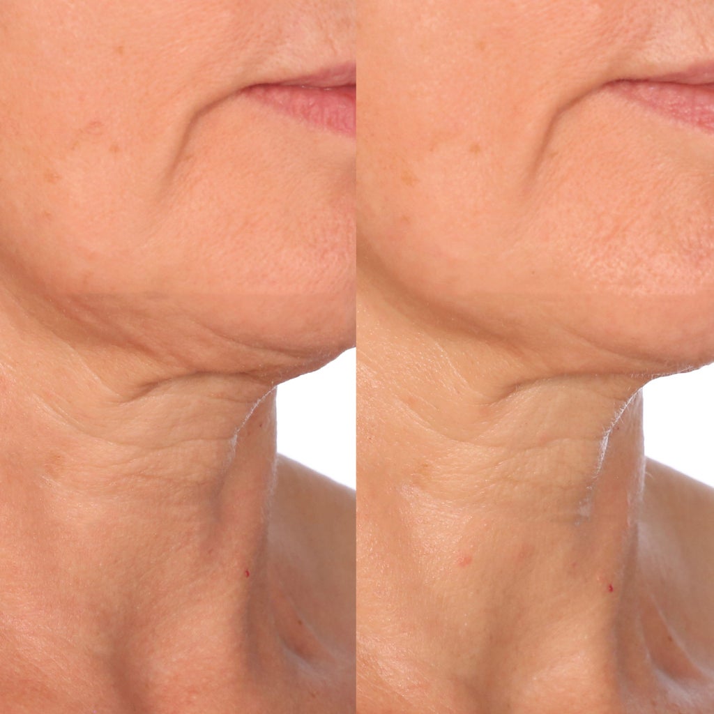 Dr. Brandt Neck Tightening Cream with Gua Sha Tool, 1.7 fl oz - product image