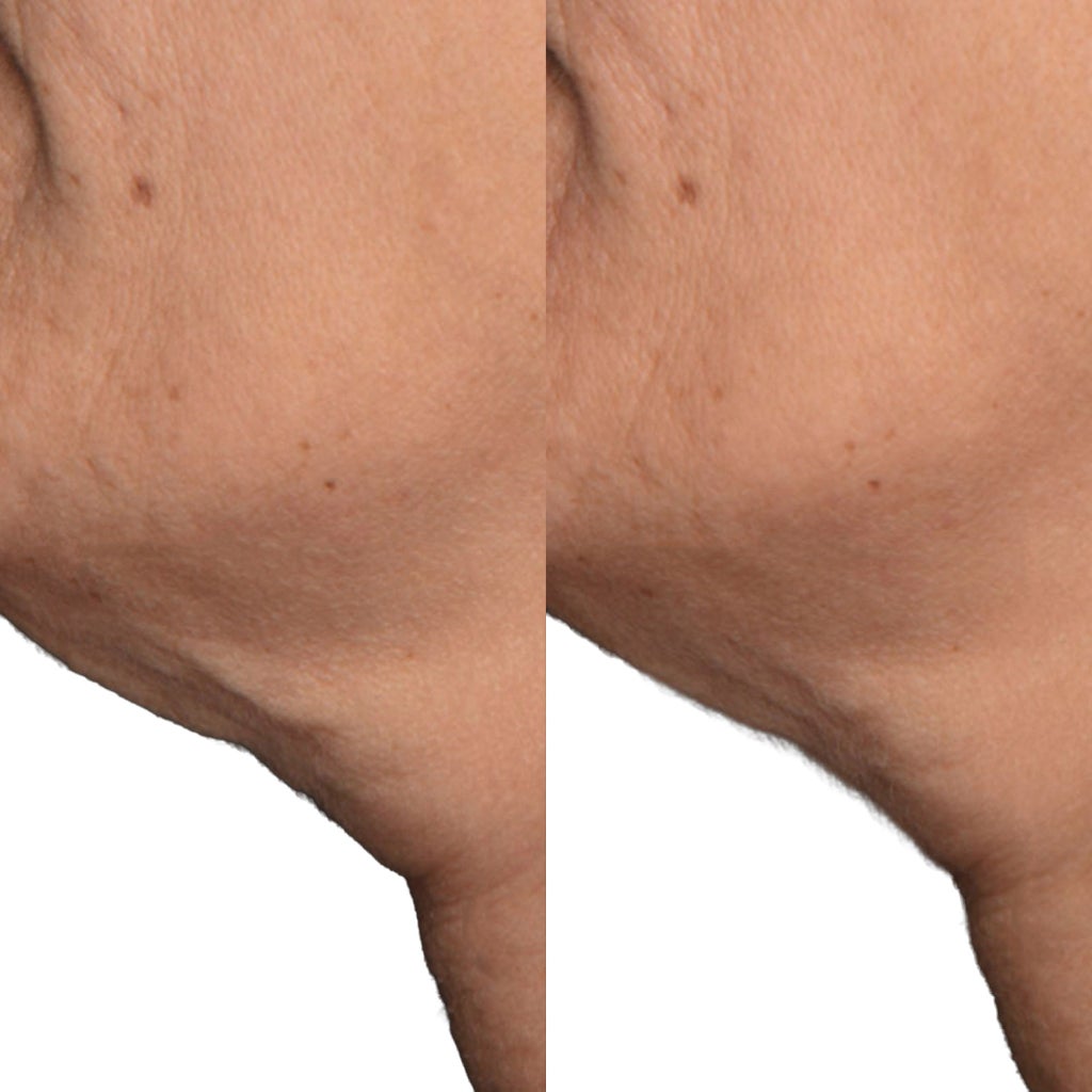 Dr. Brandt Neck Tightening Cream with Gua Sha Tool, 1.7 fl oz - product image