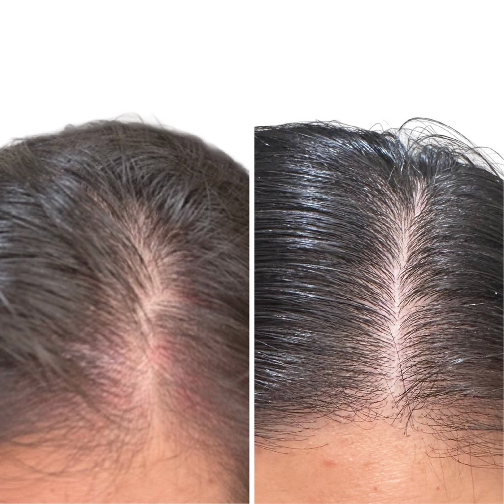 Soapbox ProGRO Density+ Scalp & Hair Serum, 1 fl oz - product image